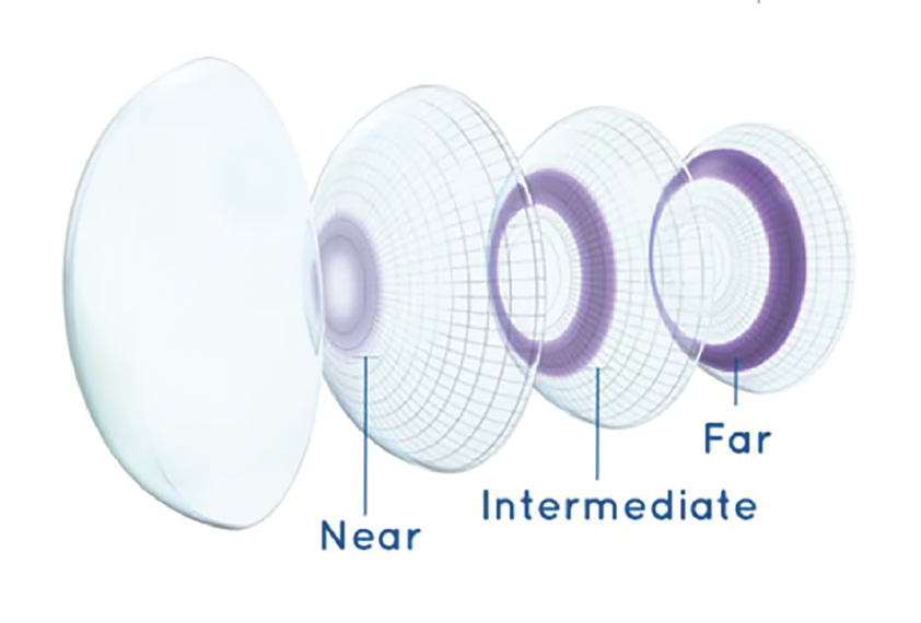 Contact Lenses 